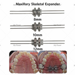Dental Expansion Screw Rapid Split Skeletal Fixation Screws/MSE Expander/Driver