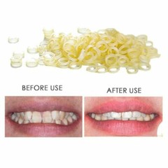 3.5 oz Dental Orthodontic Rubber Bands Elastics Latex Braces Forces 1/8 Chipmunk