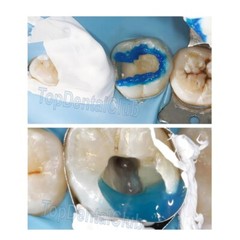 5M Dental Teflon Matrix Bands PTFT Universal Matrices System White With Blade