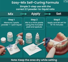 Zinc Oxide Eugenol Dental Cement Kit – Instant Tooth Repair, Crown & Bridge Fill