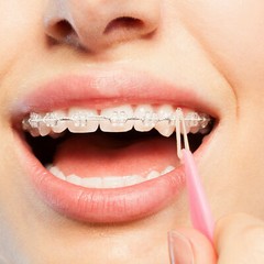 JMU Elastics Bands for Orthodontic Dental Braces Teeth Latex Free Light – Heavy