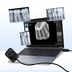 Dental X Sensor ray Digital Sensor Rayos Digital Imaging System Size 1 + Holder