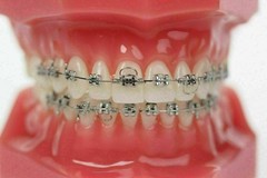 10Pc/Pack Dental Orthodontic Anterior Teeth Torque Spring Rectangular Arch L/M/S