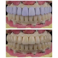 US C14 Emax Dental Glass Ceramic LT Lithium Dislicate CAD/CAM Cerec Blocks 5PCS