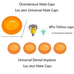 Zimmer Screw-Vent 3.5/4.5mm Locator Abutment Dental Implant Abutment & Male Caps