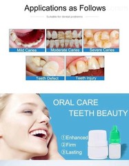 Dental Cement Tooth Repair Cavity Teeth Glue Filling Fixation Powder Liquid Set