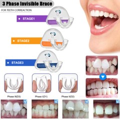 3-Stage Adult Teeth Aligners Orthodontic Braces Trainer for Dental Alignment Hot