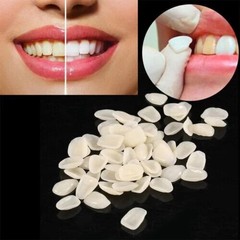 50Pcs/Pack Dental Anterior Molar Veneers Patch Porcelain Film Temporary Crown