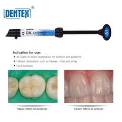 Dental Dentex Universal /Flowable Medium Flow Light Cure Composite Resin Refill