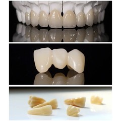 US Dental Lithium Disilicate Glass Ceramic Blocks CEREC Veneer Crown C14 CAD/CAM