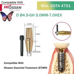 US Dental Straight Abutment Hiossen ET Osstem TS Ti Mini Regular Platform Hex