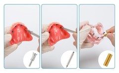 US 20Pcs Dental Overdenture Locator Implant Abutment Retention Cap Inserts Set
