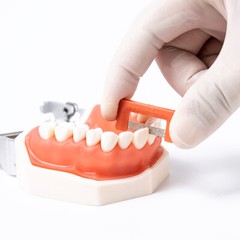 Easyinsmile IPR Orthodontics Stripping Dental Kit Interproximal Reduction Strips