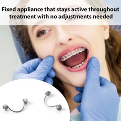 100pc Dental Ortho Torquing Torque Spring Rectangular Single Anterior Teeth wire