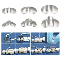 100pcs/Box Dentales Matrices Bandas de matriz de metal contorneadas se Dentista