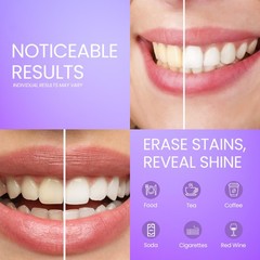 AFD Prime Purple Teeth Whitening Strips for 1 Count (Pack of 14),