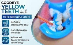 LaserGlow Professional Teeth Whitening Gel 44% Hydrogen 1 Fl Oz (Pack of 1)