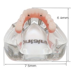 All-On-4 Dental Implant System Overdenture Treatment Teeth Model U/L Jaw W/screw