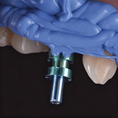 Dental DIO UFII Fixture Transfer Impression Coping Open/closed Tray Regular Hex
