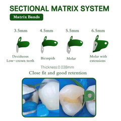 50Pcs Dental Matrix Bands PTFE Coat Non-Stick Sectional Contoured Metal Matrices