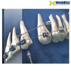1pcs Dental Orthodontic Morelli Mini Screw Hexagonal Key Short & Long Instrument