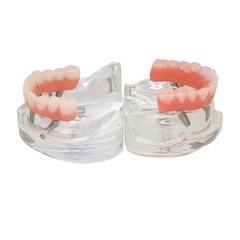 All-On-4 Dental Implant System Overdenture Treatment Teeth Model U/L Jaw W/screw