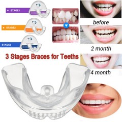 3-Stage Adult Teeth Aligners Orthodontic Braces Trainer for Dental Alignment Hot
