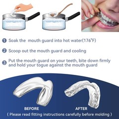 4 Pack Mouth Guards for Adults Men & Women,Large Szie, 1 Storage Case Clear