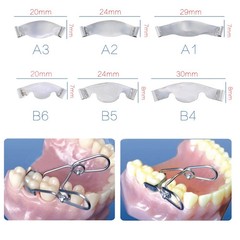 Dental Saddle Contoured Metal Matrices Matrix Band/Springclip 20Pcs/Pack