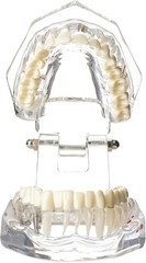 Educational Implant Typodont Model for Role Play – Perfect for Dental Schools