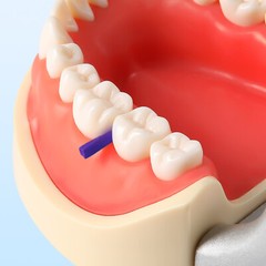 100pcs/box JMU Dental Disposable Wooden Interdental Composite Diastema Wedges
