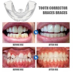 3-Stage Adult Teeth Aligners Orthodontic Braces Trainer for Dental Alignment Hot