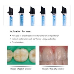 Dentex Dental Universal /Flowable Medium Flow Light Cure Composite Resin Refill