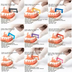 Dental Orthodontic IPR Reduction Strip Kits Interproximal Enamel Strips 10Pc/Pk