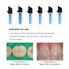 Dental Light Cure Nano Hybrid Composite Resins Dentex Universal A1 A2 A3 A3.5 US