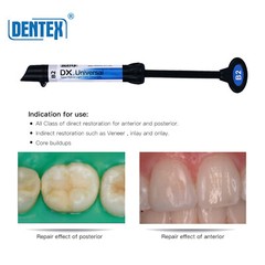 Dental Dentex Universal /Flowable Medium Flow Light Cure Composite Resin Refill