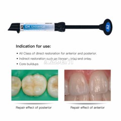 Dentex Dental Composite Light Cure Universal Resin /Acid Etching Gel 37%/Bonding