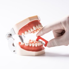 Easyinsmile IPR Orthodontics Stripping Dental Kit Interproximal Reduction Strips